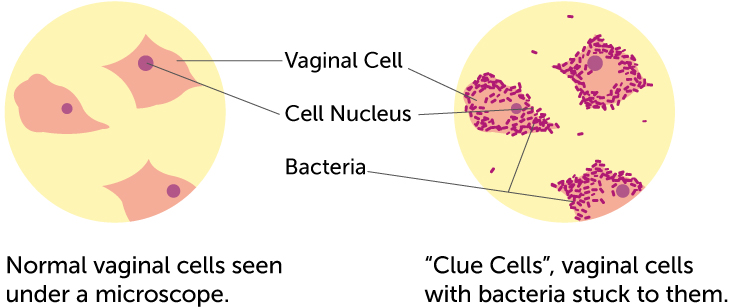 Bacteria in sperm