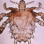 pubic louse