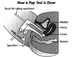 Pap test