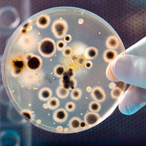 bacteria in petri dish