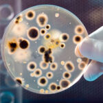 bacteria in petri dish