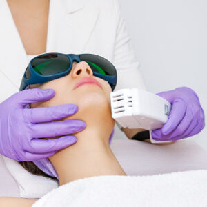 laser hair removal