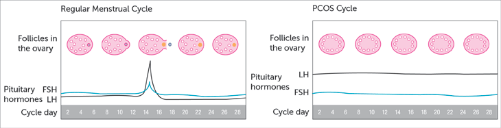 Säännöllinen vs. PCOS-kuukautiskierto